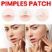 Jaysuing Pimples Patch, Repair Pockmarks Lighten Pimples Blemishes Cover Pimples_voghion.com