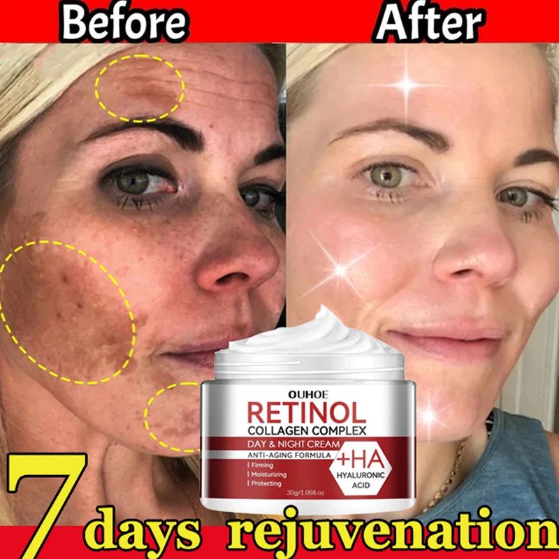 Retinol Faltenentferner Gesichtscreme Straffendes Lifting Anti Aging Verblassen Feiner Linien Feuchtigkeitsspendende Aufhellung Reparatur Hautpflege Kosmetik_voghion.com