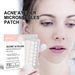 OUHOE Facial Repair and Acne Moisturizing Smooth Skin Patch_voghion.com