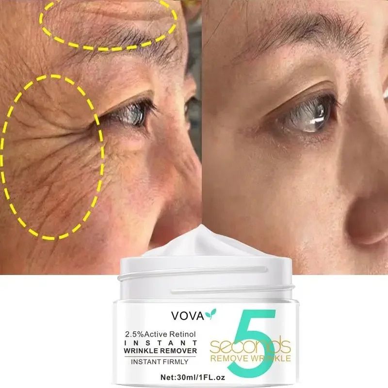 Retinol Instant Wrinkles Removal Face Cream Anti-aging Anti-Wrinkle Firming Lifting Facial Cream Fade Fine Line Facial Care_voghion.com