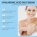 Siero Roller all'acido ialuronico, idratante, idratante e illuminante per la cura della pelle del viso_voghion.com