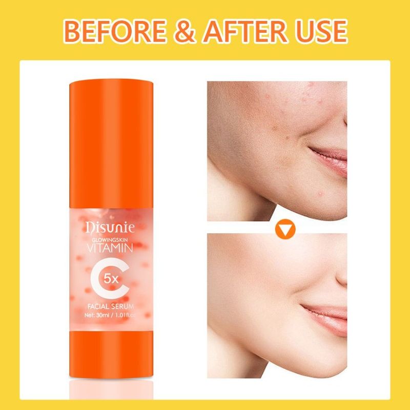 Whitening Collagen Hyaluronic For Facial Dark AntiAging Serums C Brightening Vit Serum Face Vitamin Spot C Face Acid Corrector_voghion.com