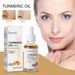 Turmeric Serum Dark Spot Corrector Remove Wrinkles Freckle Turmeric Face Cream_voghion.com