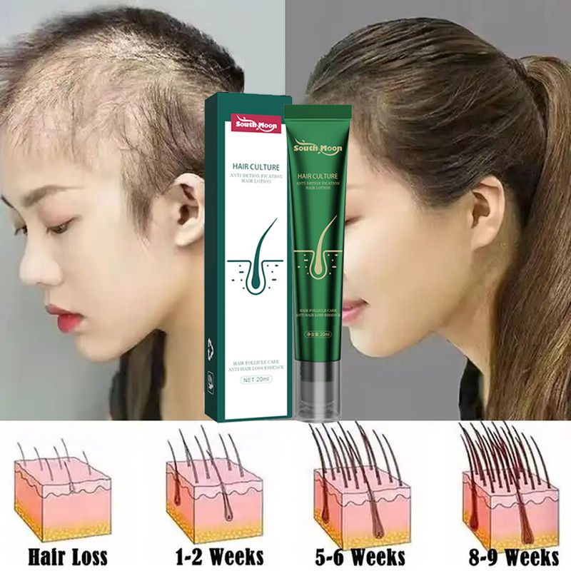 Veloce 2023 Biotina Crescita Dei Capelli Olio Ricrescita Dei Capelli Siero Trattamento Diradamento Dei Capelli Crescita Dei Capelli Liquido Anti-Perdita di Capelli_voghion.com