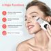 Ultrasonic Scrubber Face Spatula Skin Exfoliator Scraper And Blackhead Remover Pore Cleaner Facial Deep Cleansing New Popular_voghion.com