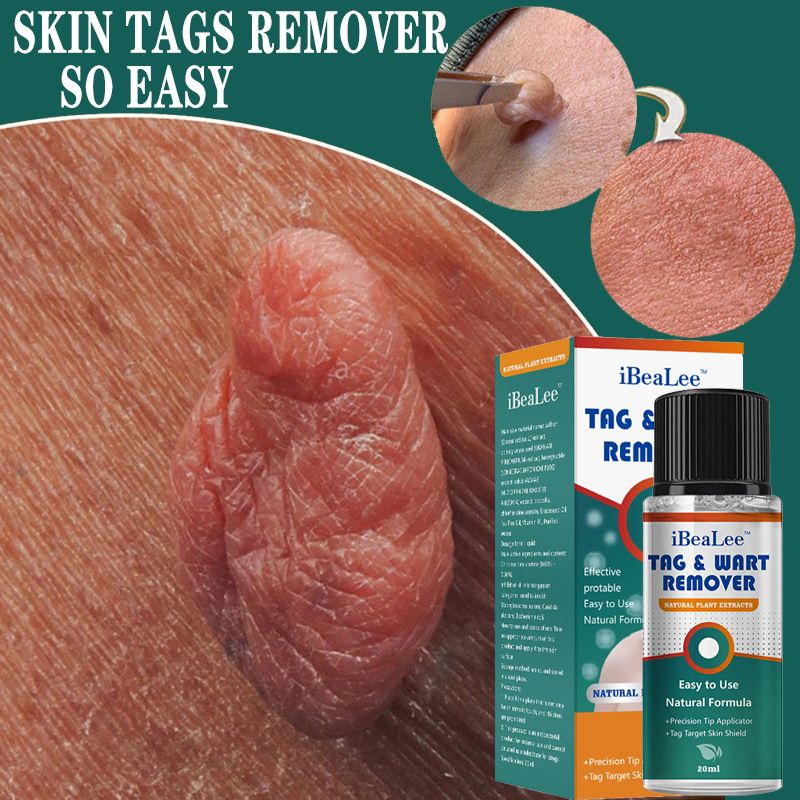 Verrues Shuowuxin, IBeaLee verrues particulièrement plates et pointues, liquide chaud et hydratant pour l'élimination des verrues du visage_voghion.com