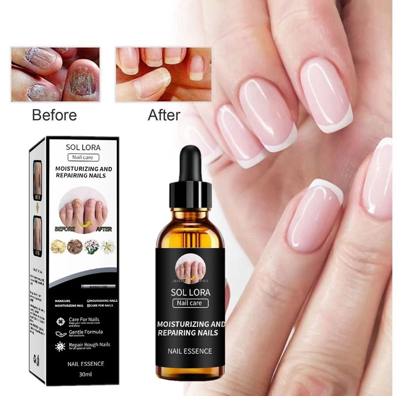 Nail repair thickens brightens removes gray dead skin on nails, and Nourishes nail care solution_voghion.com