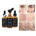 PEIME 30 ml * 3-teiliges Gesichtsessenz-Set_voghion.com