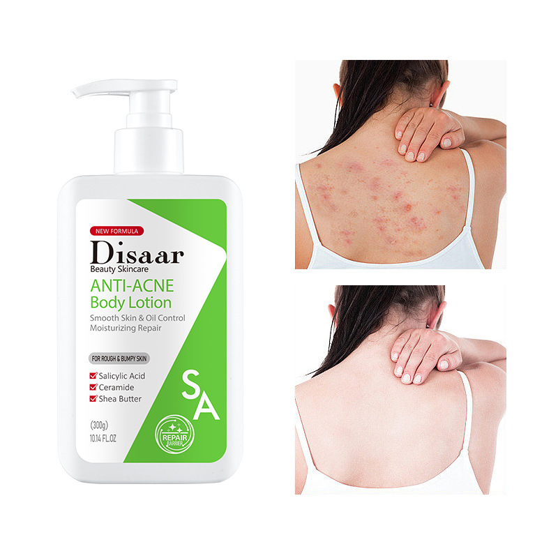 DS5325 300g Latte corpo Ceramide Acido Salicilico Confezione esclusiva per i membri 72 pezzi_voghion.com