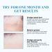 South Moon Fat Patch, Remove Facial Subcutaneous Lumps Oil Granules Plain Sweatpipe Granules Repair Patch_voghion.com