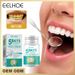 EELHOE 5-Day Whitening Clean Teeth Stains Remove Dirt Freshen Mouth Plaque Cleaning Powder_voghion.com
