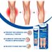 Crema per il trattamento delle vene varicose Vene del ragno Lombrico Crema per la riparazione del dolore alle gambe Seta del sangue Unguento per le gambe del ragno Assistenza sanitaria Maschio Femmina_voghion.com
