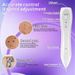 Hot Selling Home Use Picosecond Pen, Painless Beauty Device, Scarless Mole Spot Removal Device_voghion.com