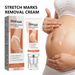 EELHOE Desalinates Body Pregnancy Scar Repair Smooth and Nourishing Skin Care Cream_voghion.com