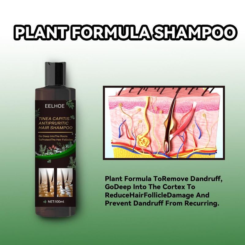 EELHOE Anti-Dandruff Shampoo - Itch Relief, Hair Loss Prevention, Oil Control &amp; Refreshing Care_voghion.com