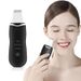 3-in-1-Ultraschall-Gesichtspeeling – Hautspatel für Tiefenreinigung, Lifting und Absorption_voghion.com