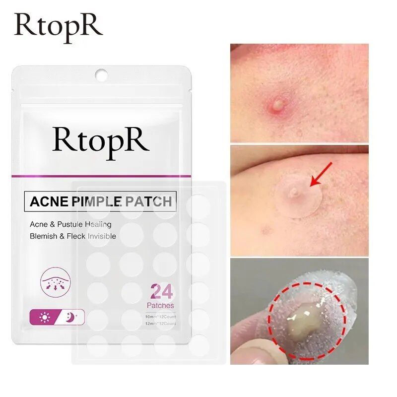 24 de patch-uri pentru acnee, patch-uri pentru coșuri, autocolante, tratament pentru acnee, instrument de îndepărtare a coșurilor, mască facială pentru îngrijirea pielii, impermeabilă_voghion.com