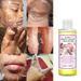 Bsncpley Exfoliating Oil Whitening Exfolierande Exfoliering Hand Ansikte Kroppsexfolierande essensolja lugnar huden_voghion.com