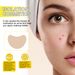 Jaysuing Acne Hydrocolloid Patch For Cleansing Facial Acne, Closing Mouth And Removing Blackheads Delicate Skin Patch_voghion.com