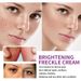 Nicotinamide Whitening Freckle Removing Cream Effectively Remove Melasma Dark Spot Acne Marks Lightening Melanin Face Skin Care_voghion.com