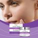 Hoygi Facial Moisturizer Moisturizes, Moisturizes, Nourishes, Brighens, And Restores Dry Skin To Keep It Hydrated_voghion.com