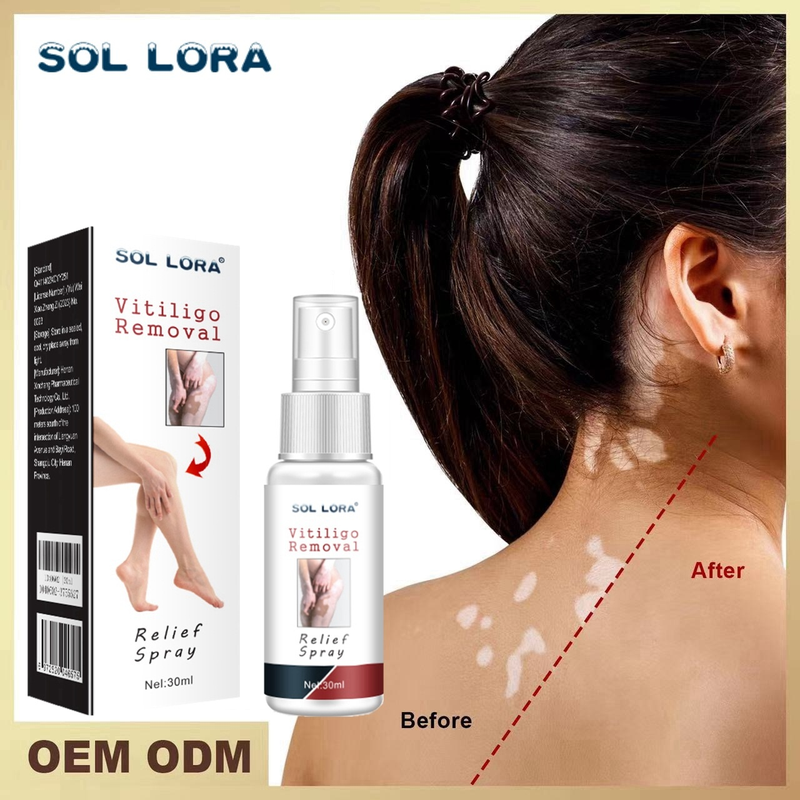 SOL LORA Psoralea White Spray detergente, lozione riparatrice per la pelle, cura delle macchie_voghion.com
