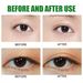 EELHOE double eyelid patch set, natural, long-lasting, invisible, breathable, traceless, glue-free, styling big eye beauty patch_voghion.com