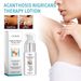 OUHOE Acanthosis Nigricans Therapy Lotion, Armpit Joint Knee Fade Melanin Deep Nourishing Whitening Skin Tender Skin_voghion.com