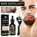 Set de suero para barba gruesa East Moon, aceite nutritivo para el tratamiento de la barba gruesa y el vello facial de los hombres_voghion.com
