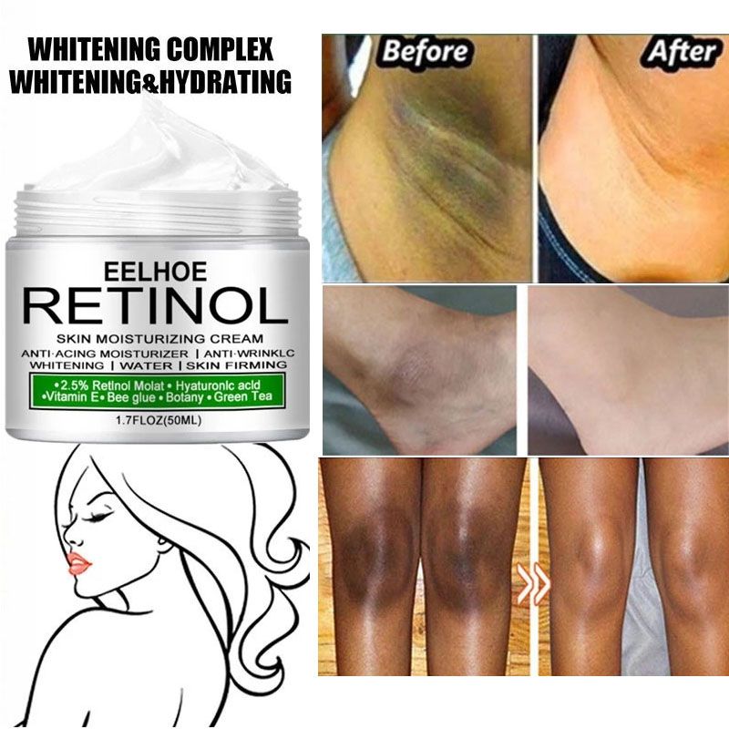 Körperaufhellungscreme, Achseln, Knie, Gesäß, dunkle Haut, Bleichmittel, verbessert die Melaninpigmentierung, stumpf, feuchtigkeitsspendend, erhellt die Hautpflege_voghion.com