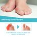 Ximonth Corrective Foot Patch Relieves Hallux Valgus Joint Pain And Swelling Foot Care Corrective Foot Patch_voghion.com