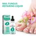 Zehennagel 2025 Für die tägliche Pflege von Händen, Füßen und Nägeln, sanfte Reinigung und äußerliche Anwendung der Reparaturlösung Hände, Füße, Nägel, Reinigung,_voghion.com