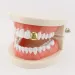 Griglie per denti in oro riempito con smalto cubico da 6 zirconi, diametri superiori e inferiori, griglie hip hop, gioielli raffinati Miami Bling per uomo._voghion.com