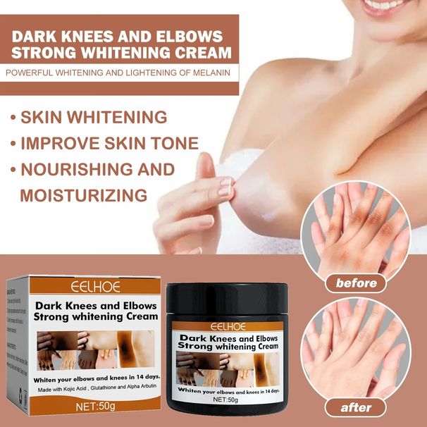 Whitening Body Cream Remove Melanin Dark Knuckles Remover Gel Joint Elbow Private Part Underarm Bleaching_voghion.com