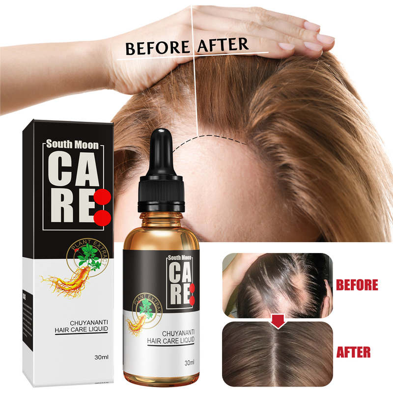 Olio essenziale di radice di cuoio capelluto Essenza di crescita rapida Balsamo nutriente antigoccia per capelli_voghion.com