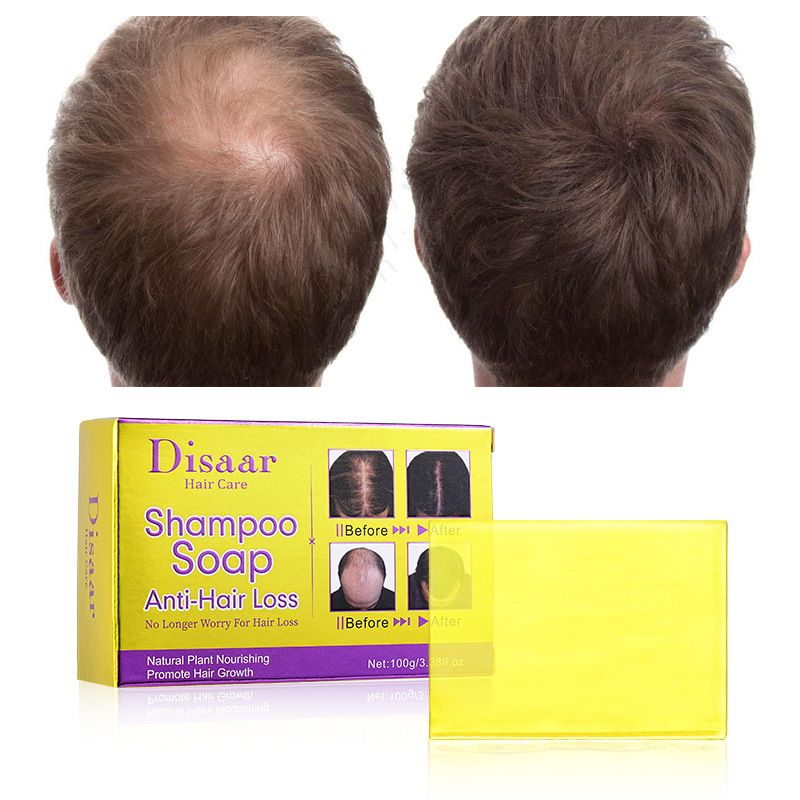 DS5236 100g Ingwer-Shampoo Exklusive Mitgliederbox 192St_voghion.com