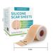 Silicone Scar Sheets, 1 Roll Reusable Scar Removal Sheet, Professional Scar Removal Tape For C-section, Surgery, Burns, Keloids, Acne, Scarbandages_voghion.com