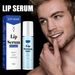 Lip essence ball liquid can fade lip lines, prevent dry cracks dead skin, plump and moisturize lips_voghion.com