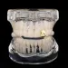 YONGX Gold Silver Monochrome Teeth Grilz Classic Hip Hop Gloss Hat Mens Jewelry Halloween Gift 241210_voghion.com