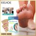 Patch réparateur pour les coins des pieds, les cocons, l'hydratation des peaux mortes, le nettoyage de la peau et le soin des yeux_voghion.com