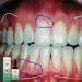 Gocce di siero per la riparazione rapida delle gengive, alleviano la recessione gengivale, cura delle vesciche parodontali, sbiancamento dei denti, rimozione del mal di denti giallo, dentifricio_voghion.com