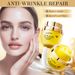 Full English Bee Venom Firming Mask SADOER Anti-Wrinkle Moisturizing Cream_voghion.com
