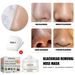 EELHOE Removing Mask, Purifying and Nourishing Patch, Cleaning Acne, Blackhead T-Zone Care, Shrinking Pore Nose Patch_voghion.com