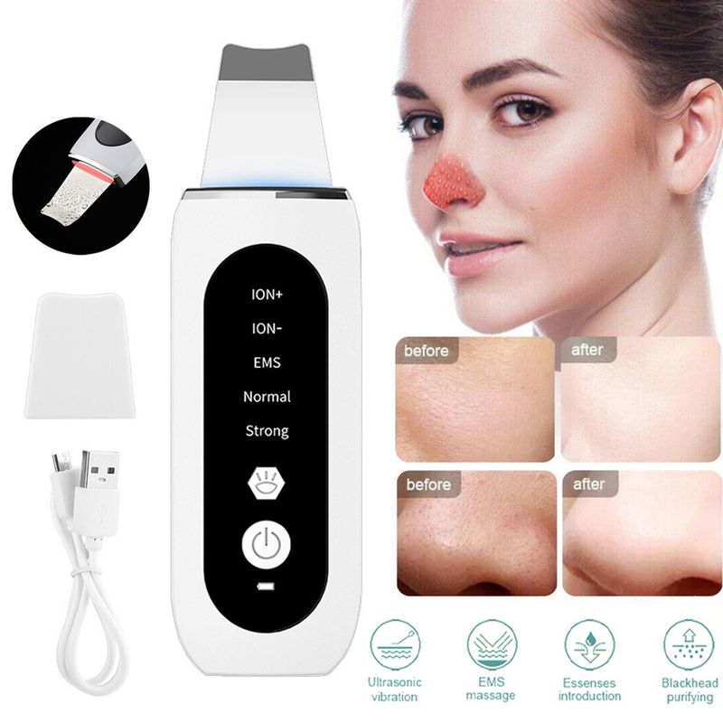 Ultrasonic Facial Skin Scrubber Face Pore Deep Cleaner Spatula Blackhead Remover_voghion.com