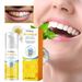 Oralhoe Propolis Pulizia orale Cura delle macchie dei denti Dentifricio in mousse fresca_voghion.com