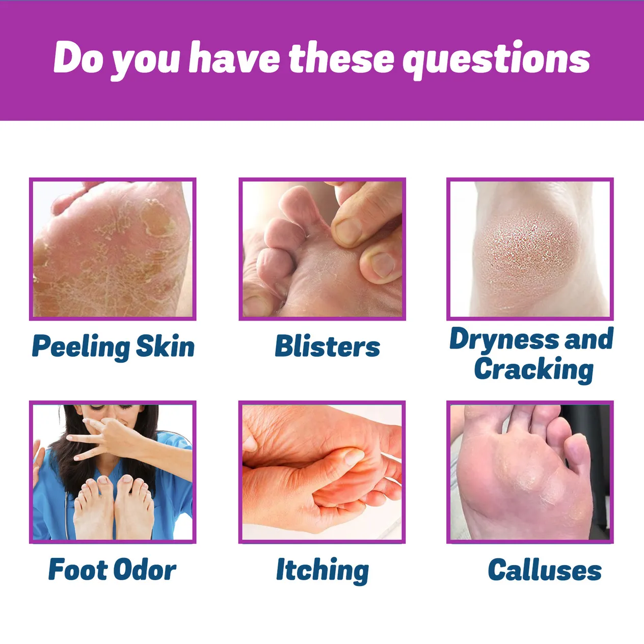 Ximonth kopšanas līdzeklis, lai mazinātu pēdu sviedru smaku, mazinātu smaku, apturētu niezi un tīrītu pēdas_voghion.com