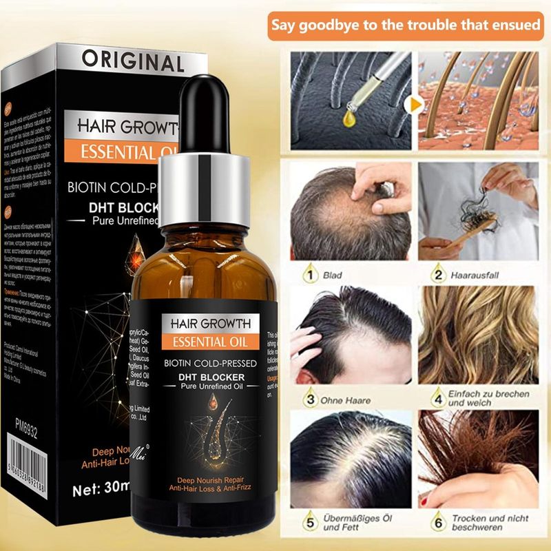 Ätherisches Haarwachstumsöl, Biotin, kaltgepresster DHT-Blocker und Haarwachstumsshampoo, Anti-Haarausfall-Conditioner, Haaraccessoires_voghion.com