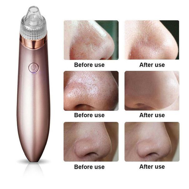 Aspirateur électrique pour points noirs, nettoyeur de pores, élimine les boutons d'acné, outil d'aspiration puissant, élimine les points noirs, aspiration sous vide des pores, dermabrasion au diamant F_voghion.com