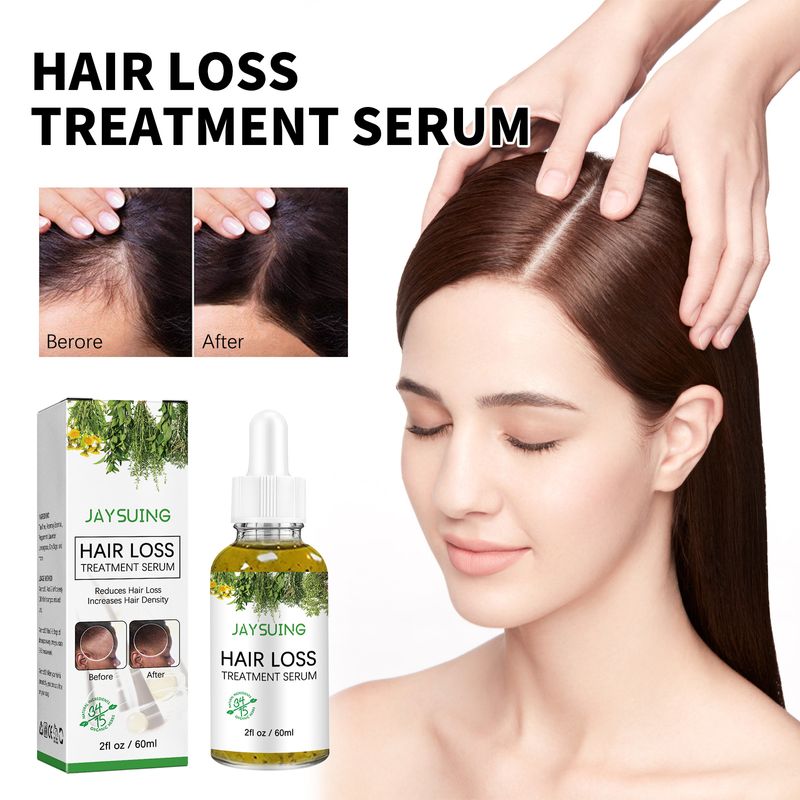 Haarausfall-Behandlungsshampoo Anti-Juckreiz Anti-Schuppen-Kontrolle Haarwachstumsserum Öl Kopfhautwurzel Dicker Schnelles Nachwachsen Essenz_voghion.com