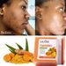 Kojic Acid Dark Spot Remove Zeep voor het reinigen van het gezicht Oliecontrole Egale huidskleur Producten Natuurlijke kurkuma zeep bar Nieuw_voghion.com